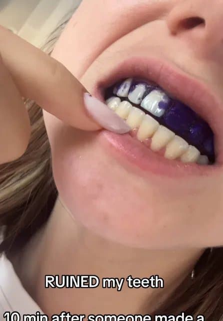 RUINED my teeth
10 min after someone made a
comment on my teeth