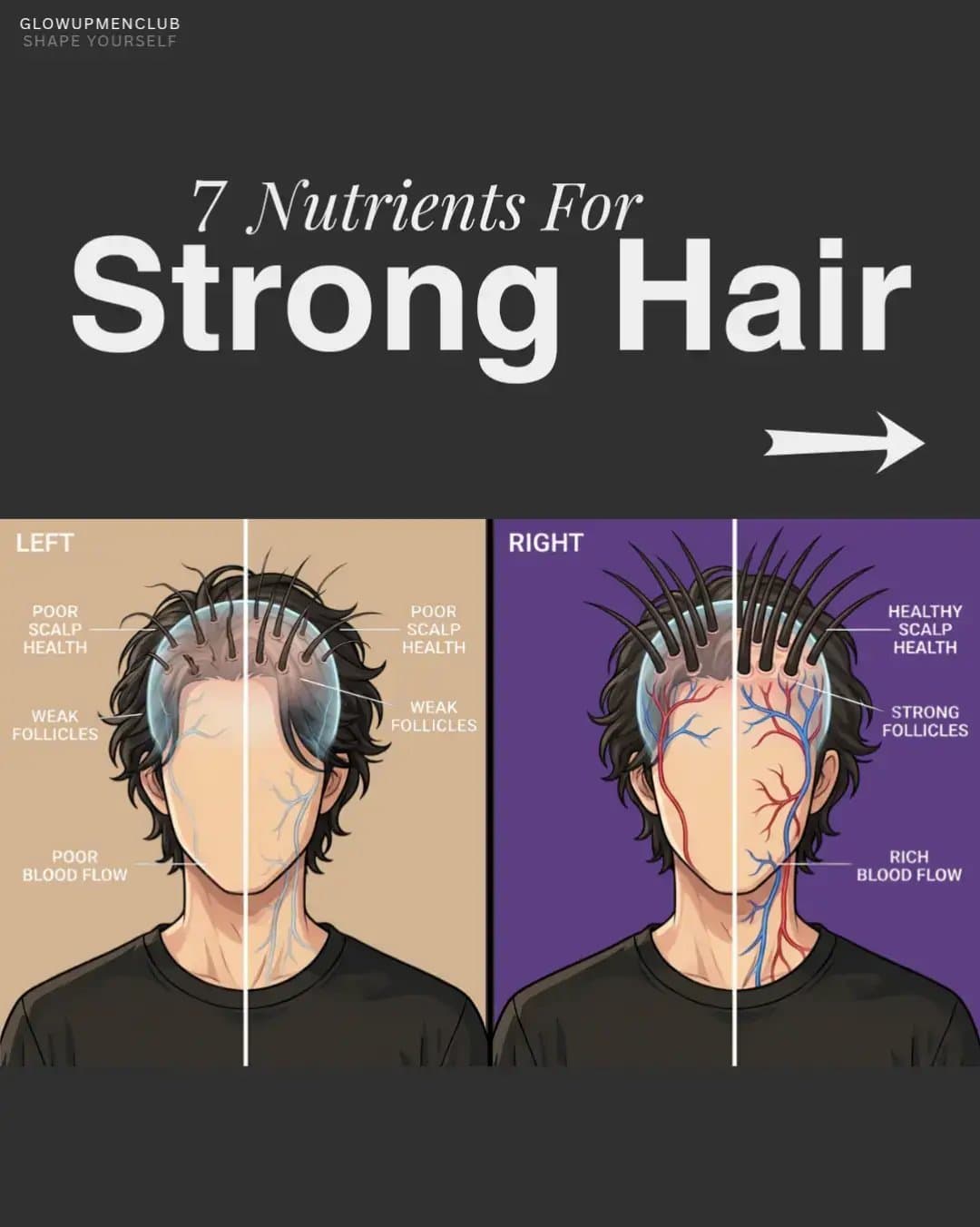GLOWUPMENCLUB
SHAPE YOURSELF
7 Nutrients For
Strong Hair
LEFT
RIGHT
POOR
SCALP
H…