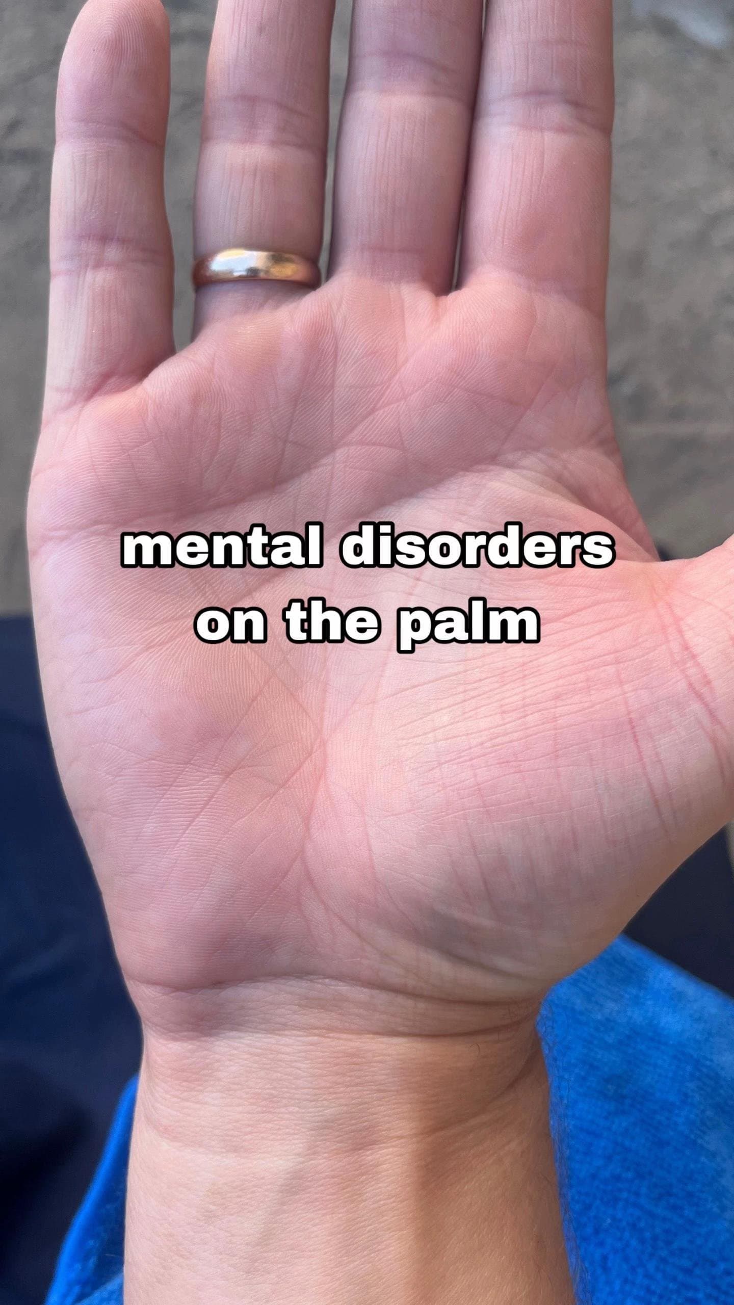 Slide 1: mental disorders
on the palm