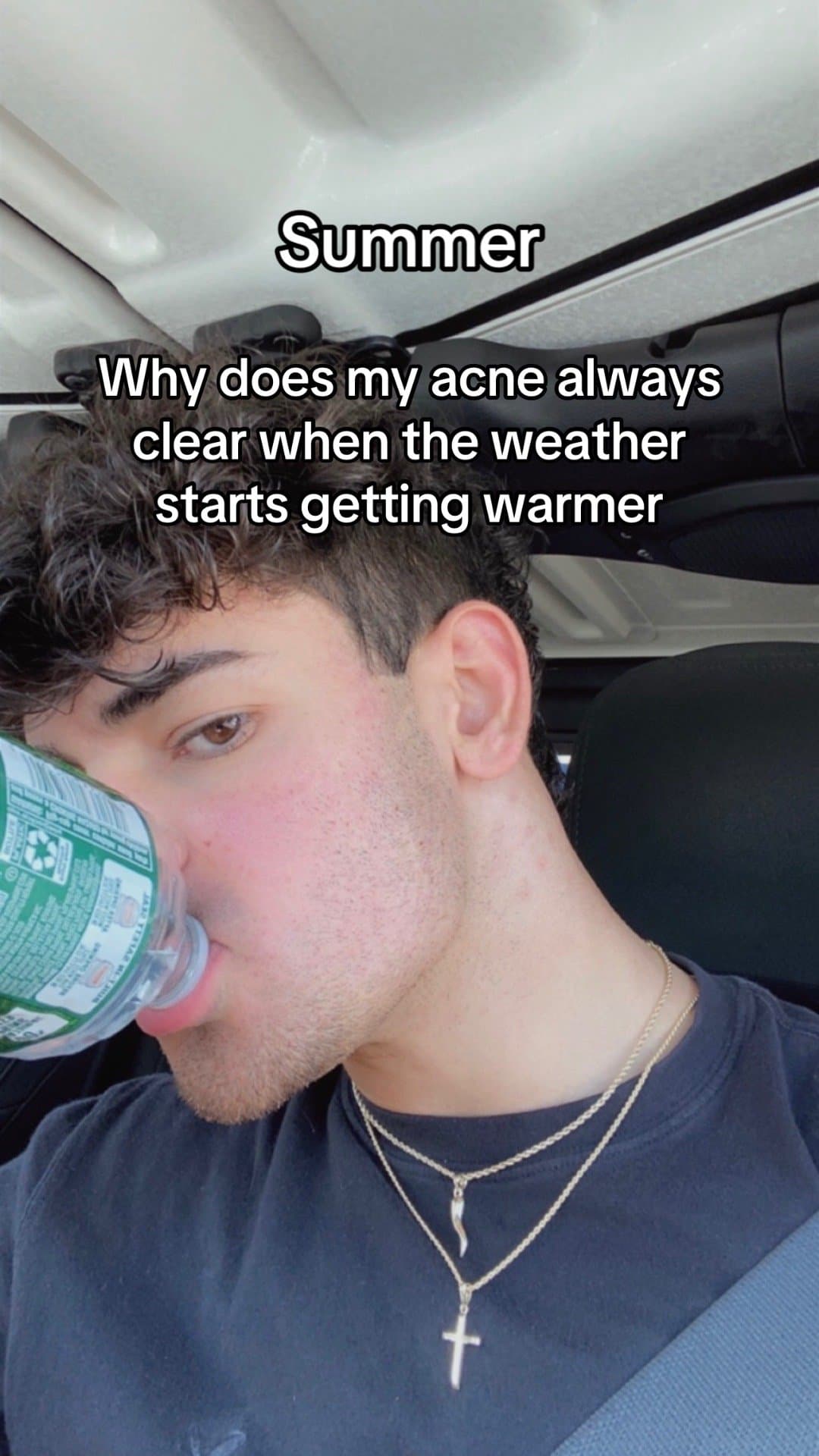 Slide 1: Summer
Why does my acne always
clear when the weather
starts getting warmer