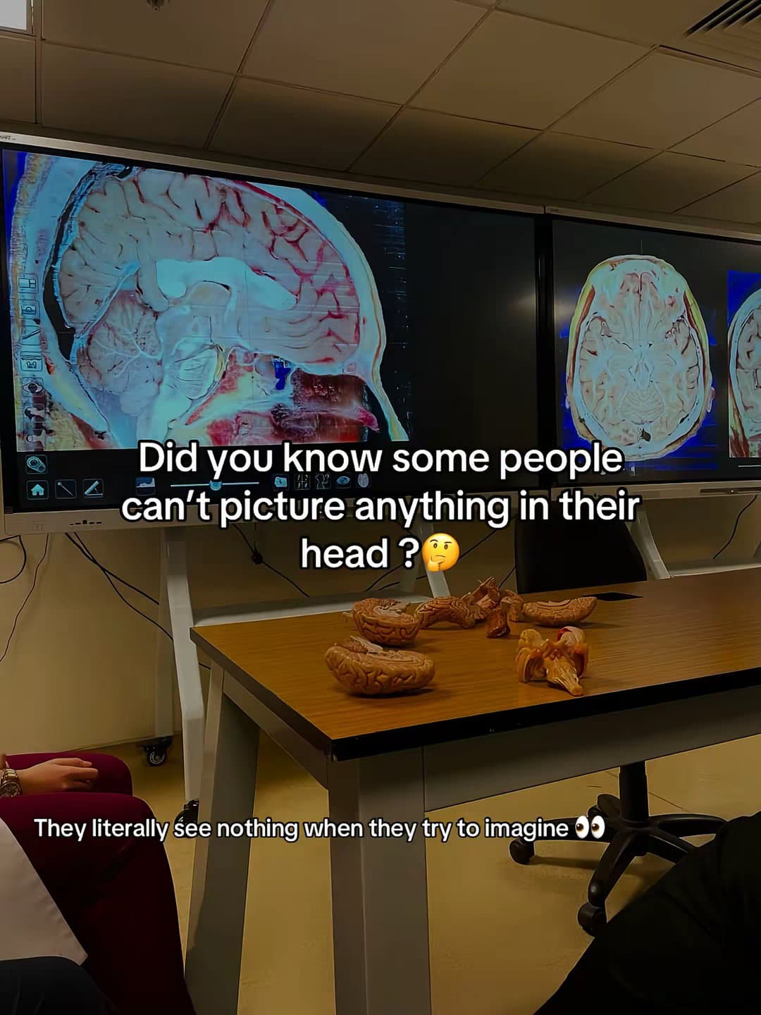 Did you know some people can't picture anything in their head?
They literally se…