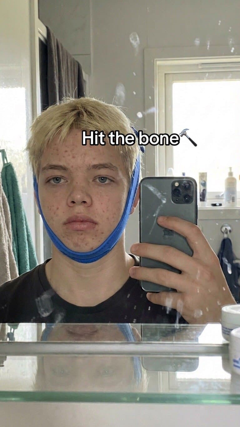 Slide 1: Hit the bone🔨