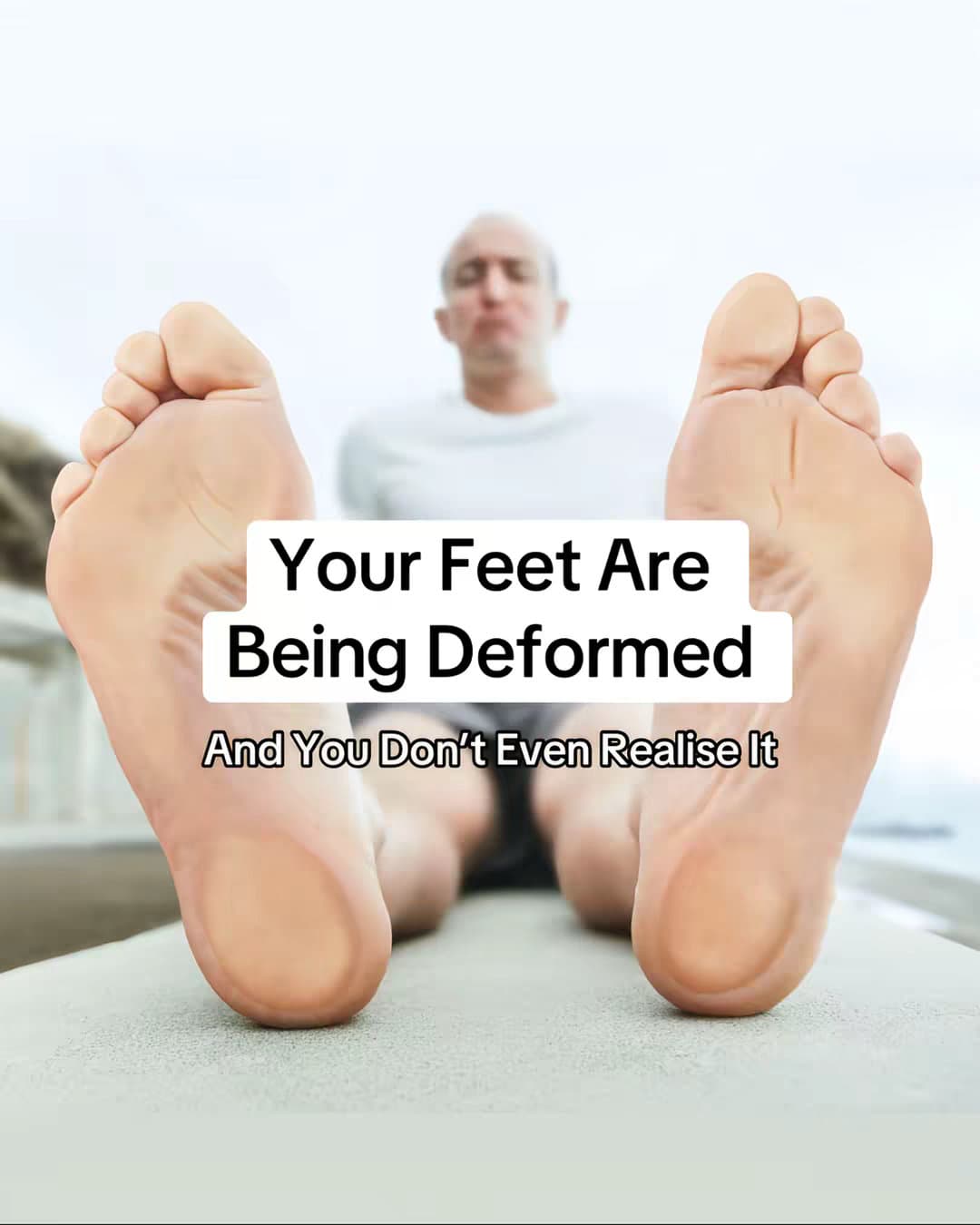 Slide 1: Your Feet Are Being Deformed
And You Don't Even Realise It