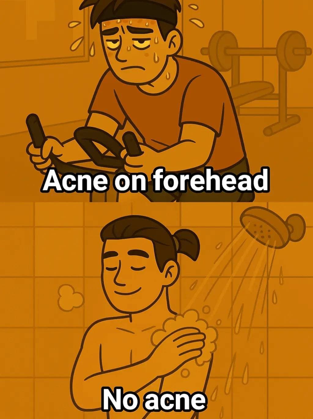 Slide 1: Acne on forehead
No acne