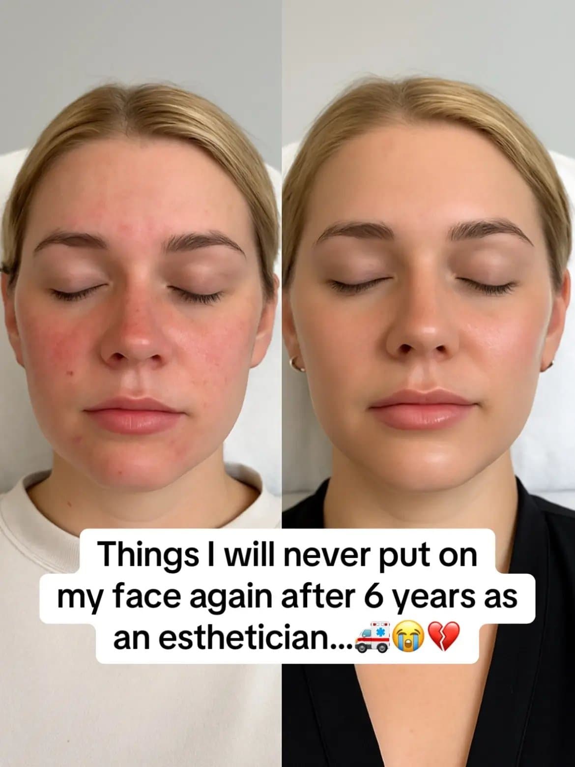 All of these 💩 products
have nothing to do with real
skincare
0/10 🔴
If you…