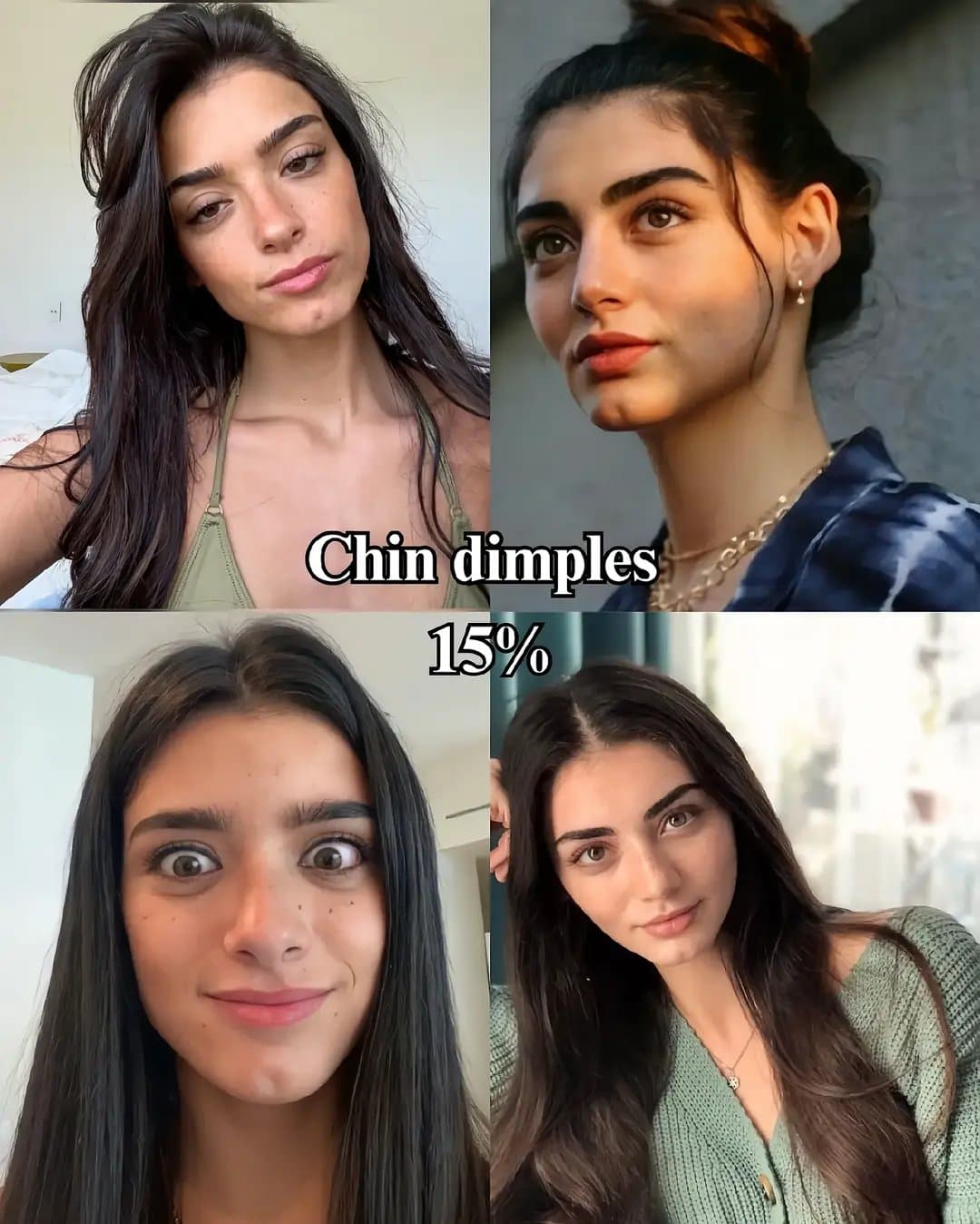 Chin dimples
15%