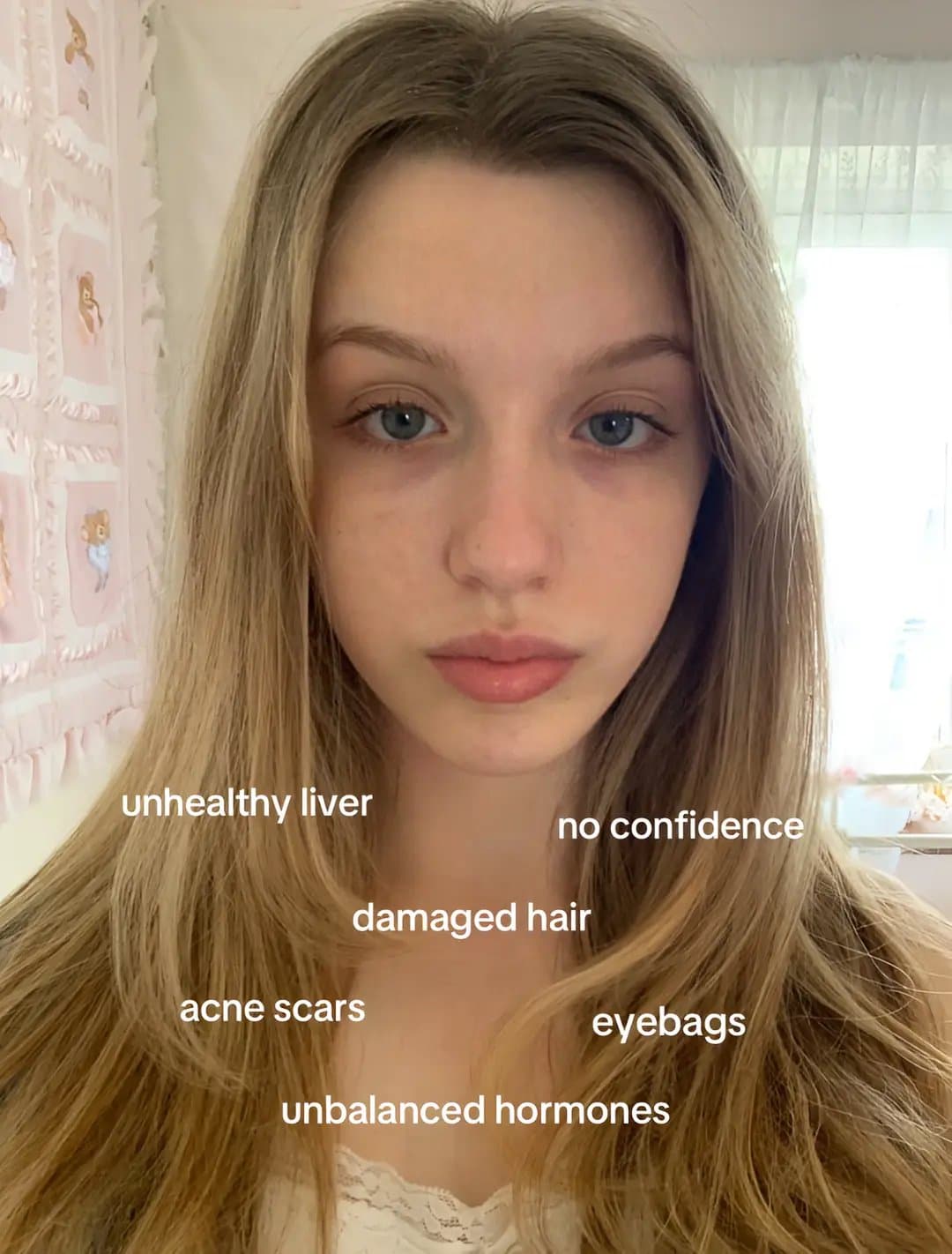 unhealthy liver
no confidence
damaged hair
acne scars
eyebags
unbalanced hormone…