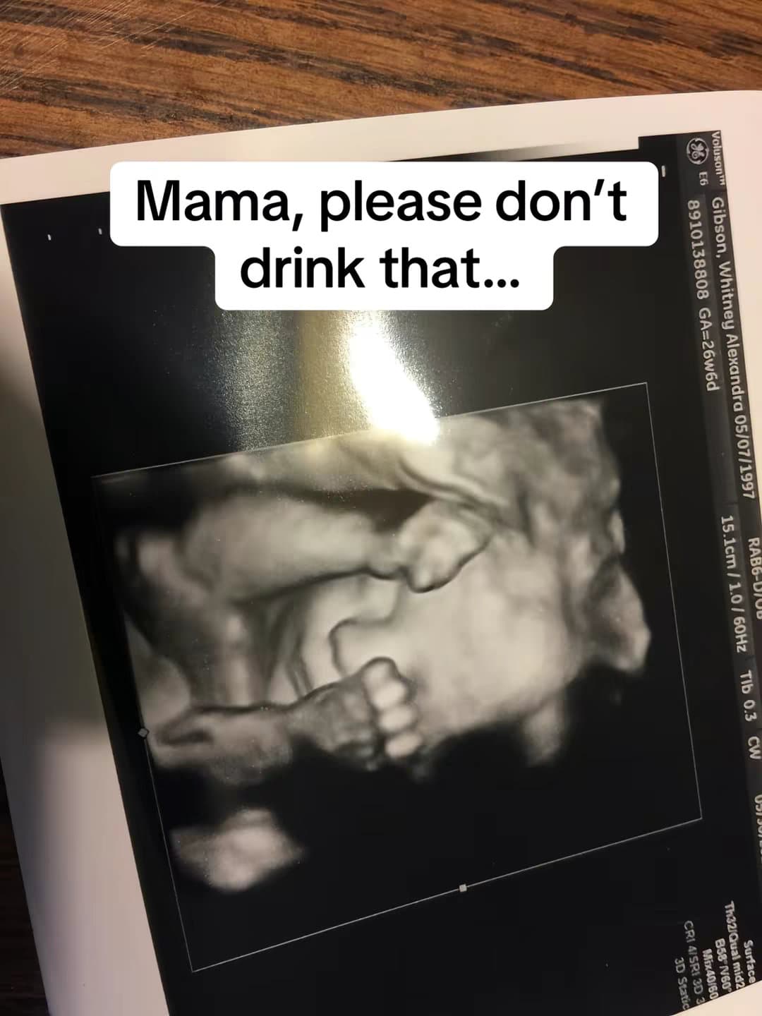 It can hurt my brain
Diet sodas
Energy drinks
Sweetened coffee drinks