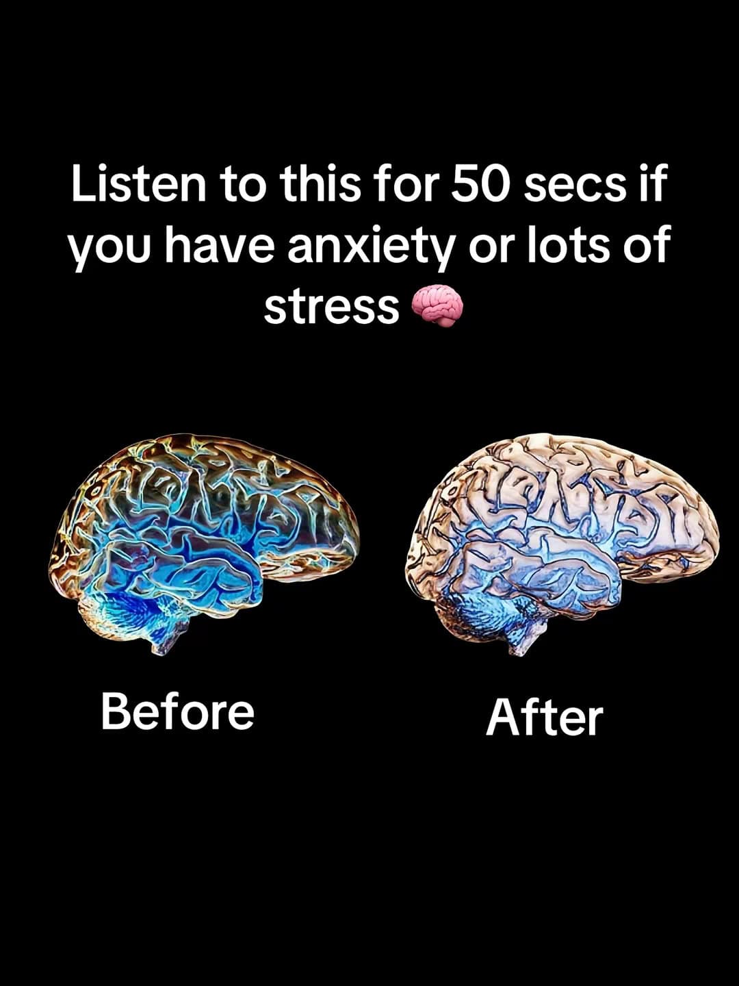 Slide 1: Listen to this for 50 secs if
you have anxiety or lots of
stress 🧠
Before
After